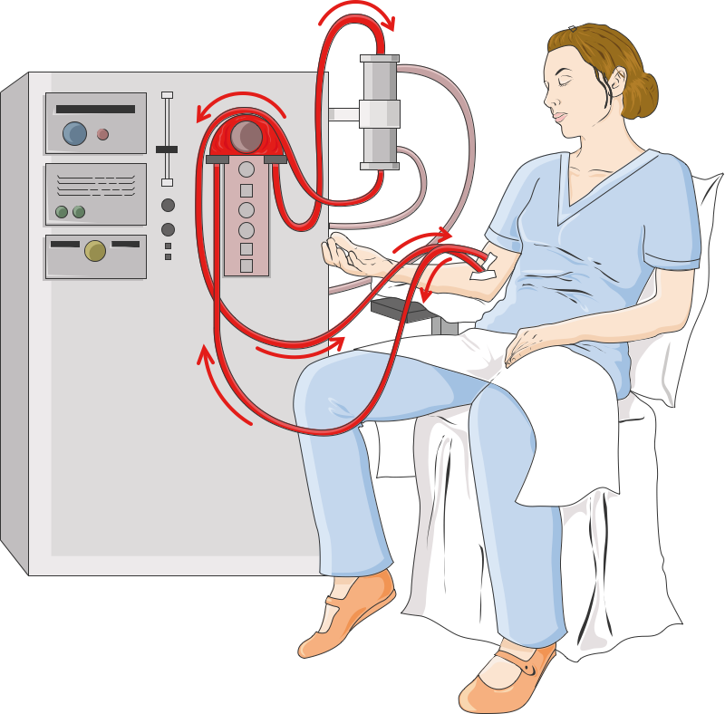 Hemodilaysis hastaları ne yememeli? - Kapak Görseli